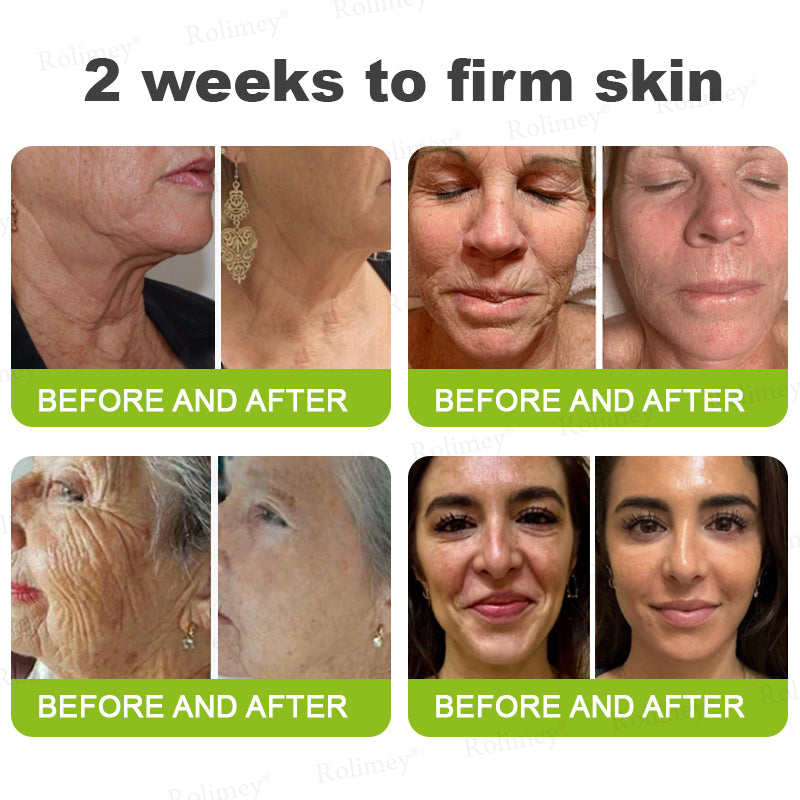 ✨👨‍⚕️Made and shipped from the USA 💫Rolimey® Botox & Vita-A Retinol Shot Wrinkle-Lift Tightening cream - Last Day Promotion 70% OFF