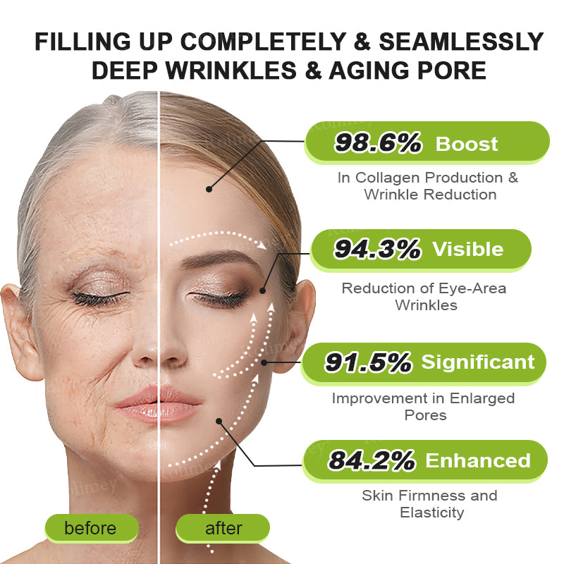 ✨👨‍⚕️Made and shipped from the USA 💫Rolimey® Botox & Vita-A Retinol Shot Wrinkle-Lift Tightening cream - Last Day Promotion 70% OFF