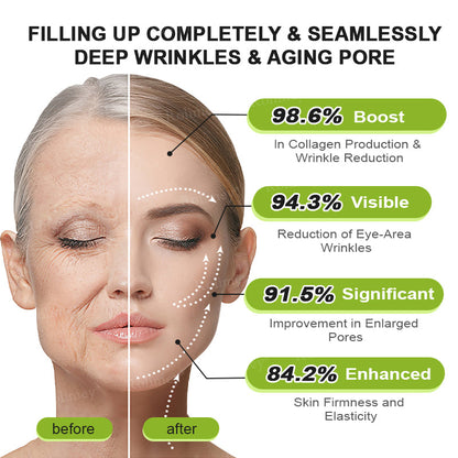 ✨👨‍⚕️Made and shipped from the USA 💫Rolimey® Botox & Vita-A Retinol Shot Wrinkle-Lift Tightening cream - Last Day Promotion 70% OFF