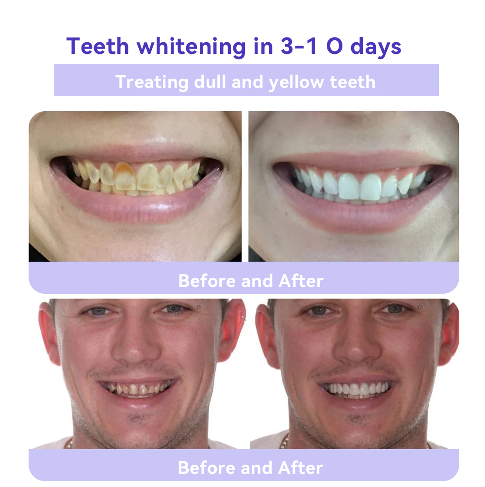 🔥🏆 4 Boxes of Teeth Whitening Mineral Powder