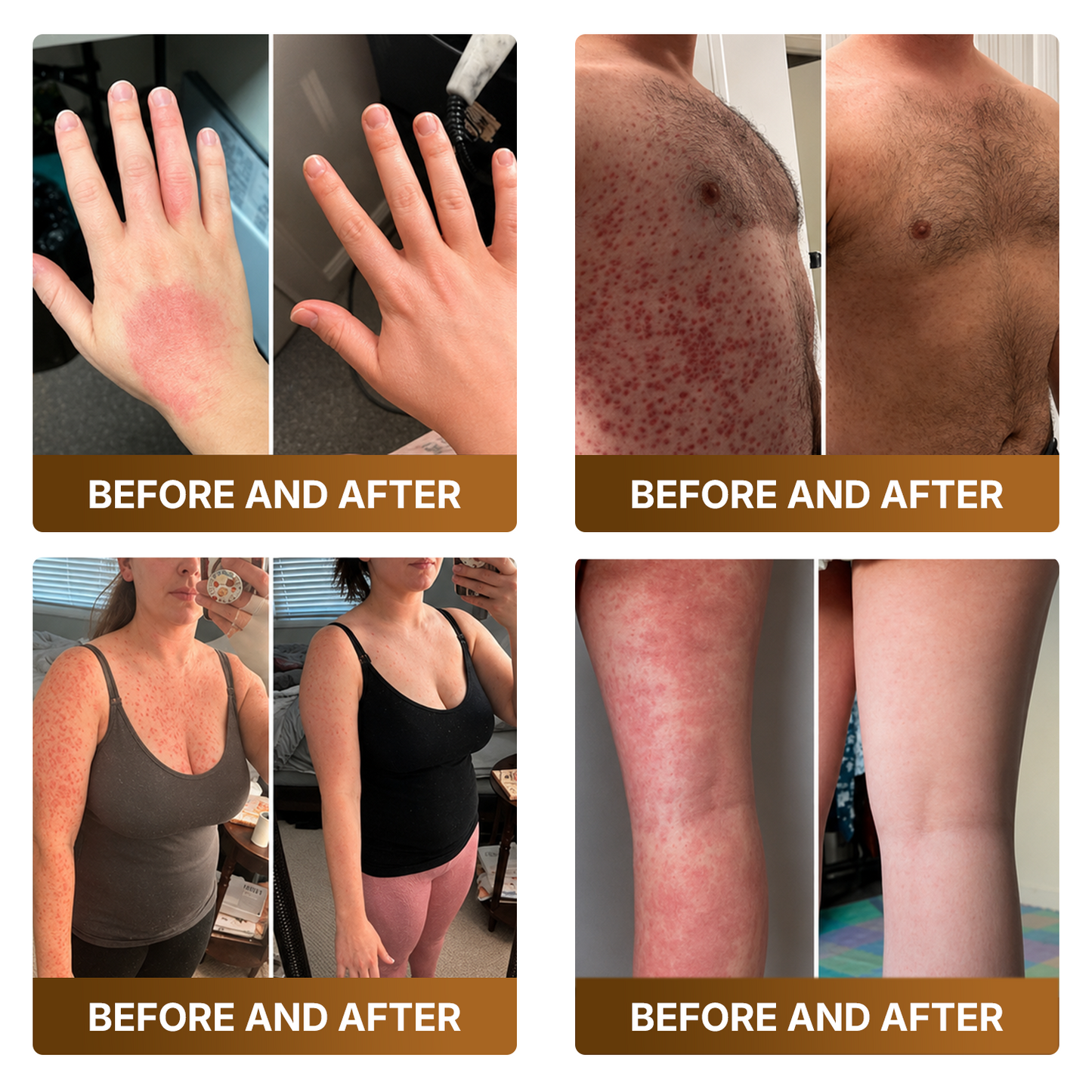 🛒 An additional 30% discount👑Made and Shipped from Canada ✨🔥 DOCTIA® Botox & Bee Venom Advanced Recovery Cream—For Wrinkles, Sagging Skin, Skin Tags & Rough Bumps