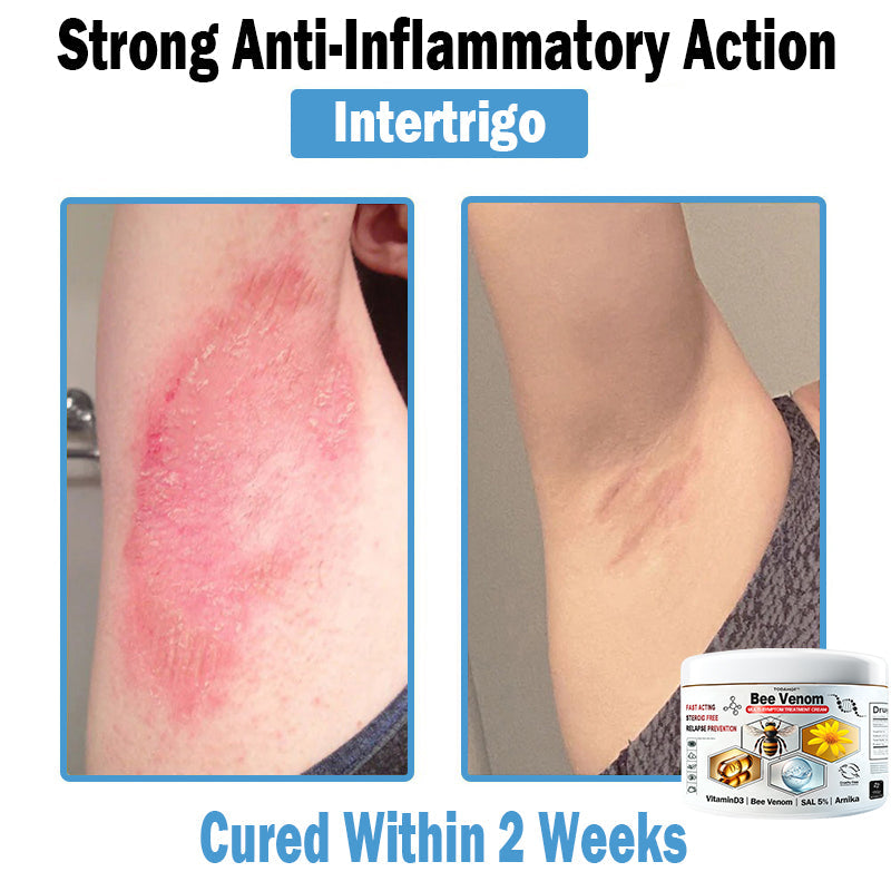 2 Jars⭐️Instant Relief - A$ 42.97
